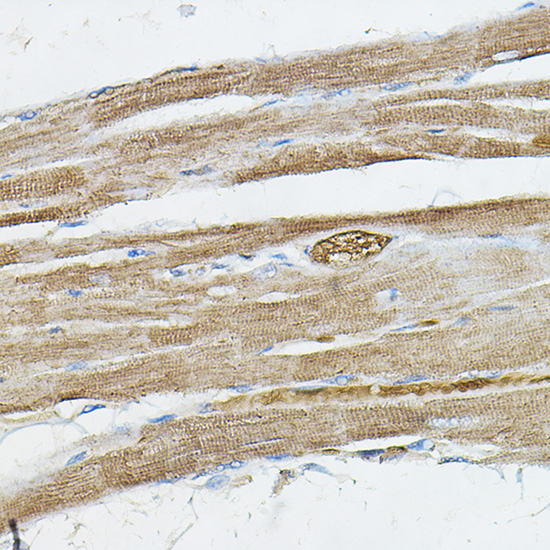 IRAK4 antibody