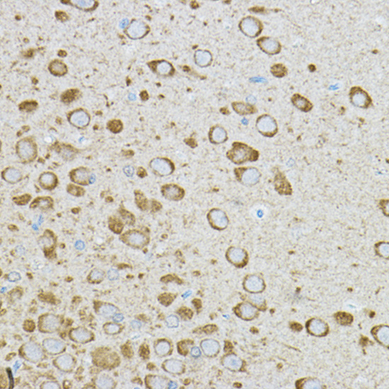 IRAK4 antibody