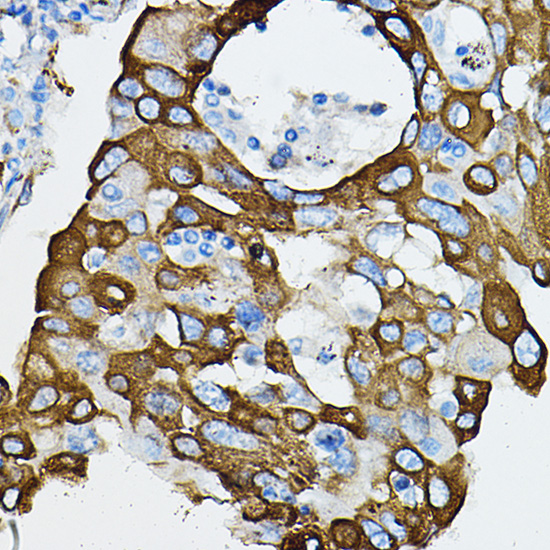 IRAK4 antibody