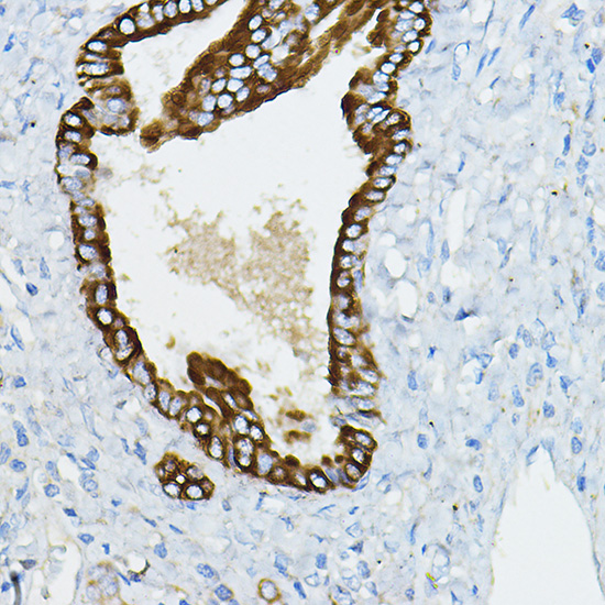 IRAK4 antibody