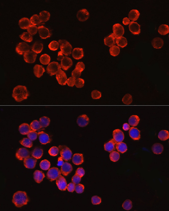 IRAK4 antibody