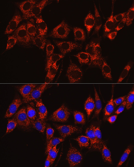 IRAK4 antibody
