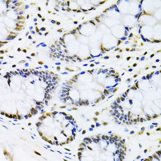 CBX8 antibody