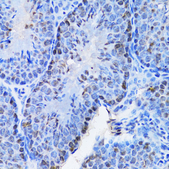 CBX8 antibody