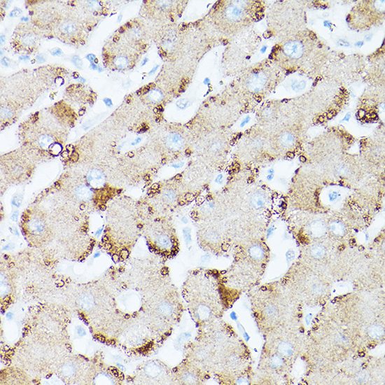 HSD17B13 antibody