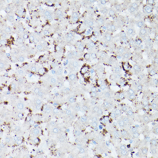 HSD17B13 antibody
