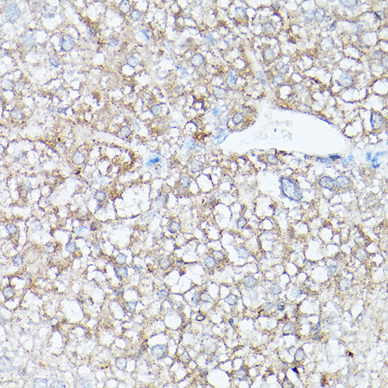 HSD17B13 antibody