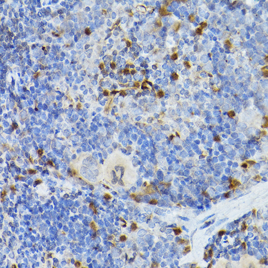 SERPINB1 antibody