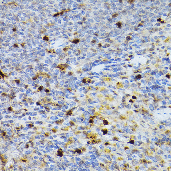 SERPINB1 antibody