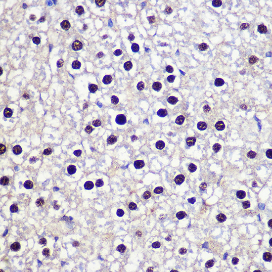 TKT antibody