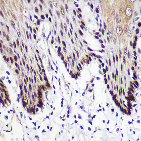 TKT antibody