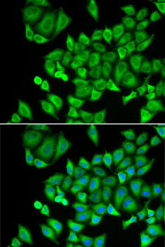 DHRS9 antibody