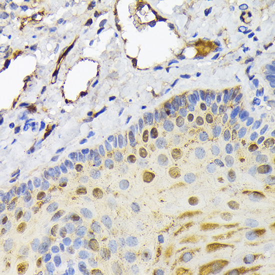 FABP5 antibody