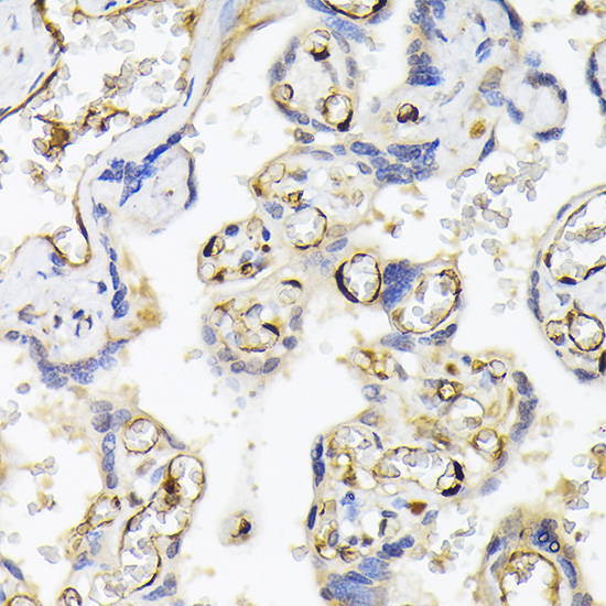 FABP5 antibody