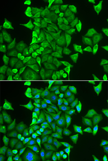 CARS antibody