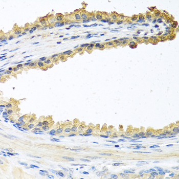 COCH antibody