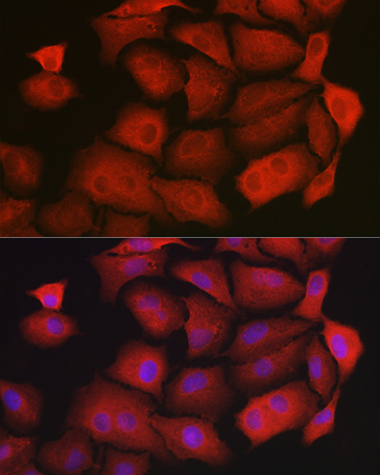 GAMT antibody
