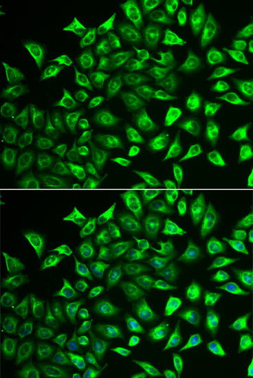 MMRN1 antibody