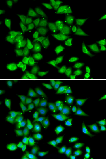 NFATC3 antibody
