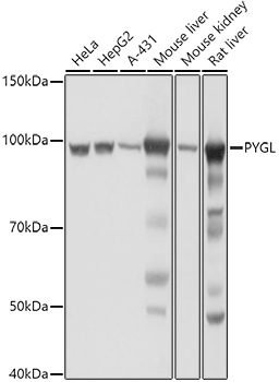 PYGL antibody