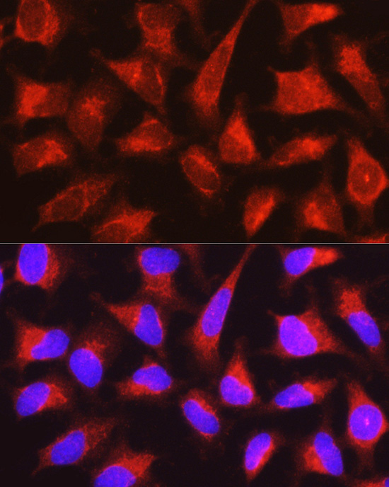 PYGL antibody