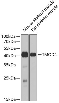 TMOD4 antibody