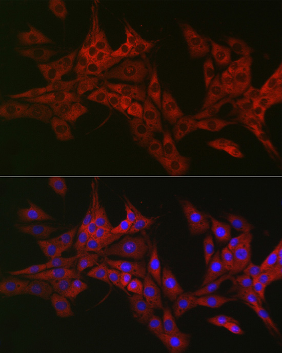 TRAF3IP2 antibody