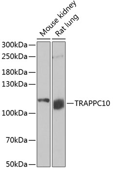TRAPPC10 antibody