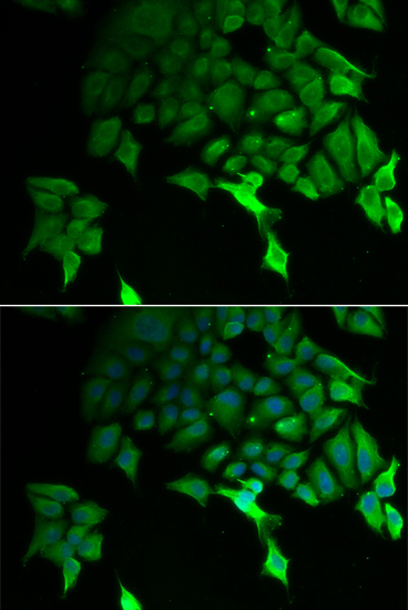 TSC22D3 antibody