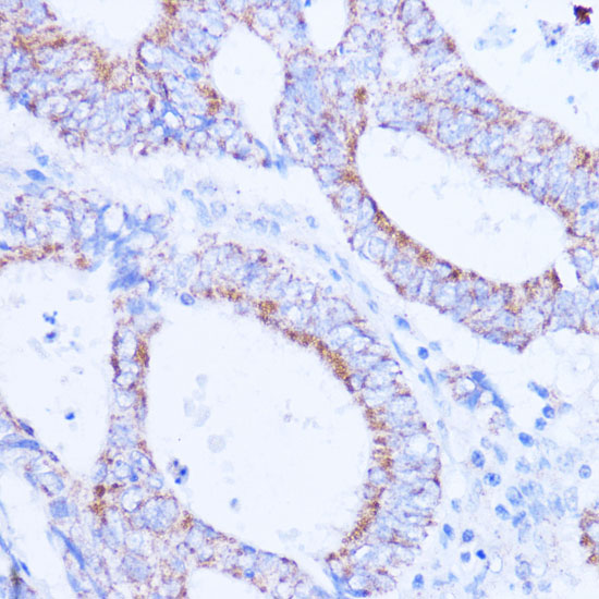 SIRT3 antibody