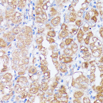 SPON2 Rabbit Polyclonal Antibody