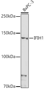 IFIH1 Rabbit Polyclonal Antibody
