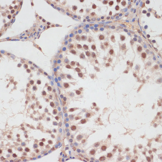 HP1BP3 Rabbit Polyclonal Antibody