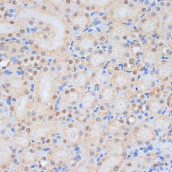 HP1BP3 Rabbit Polyclonal Antibody