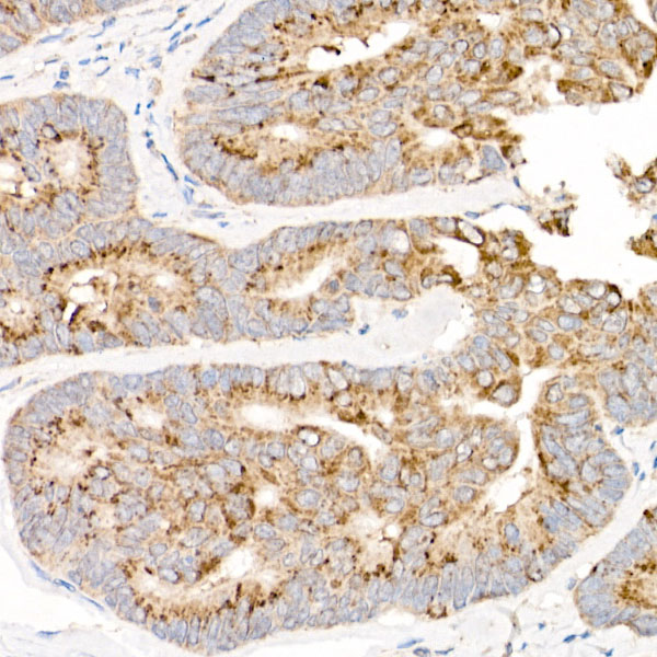 MT-ND2 Rabbit Polyclonal Antibody