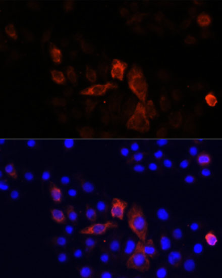 MT-ND2 Rabbit Polyclonal Antibody