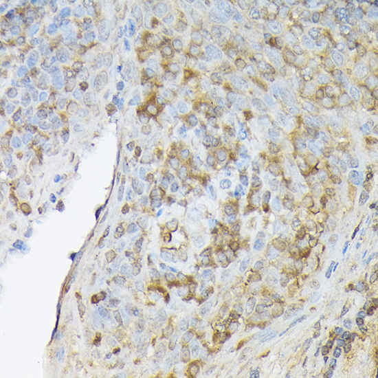 CXCL12 Rabbit Polyclonal Antibody