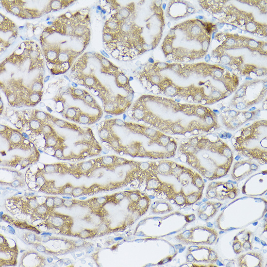 BCAR1 Rabbit Polyclonal Antibody