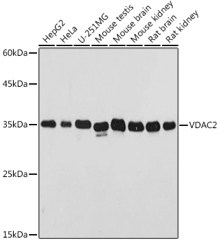 VDAC2 Rabbit Polyclonal Antibody