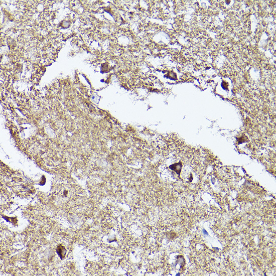 VDAC2 Rabbit Polyclonal Antibody
