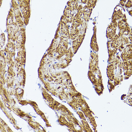 VDAC2 Rabbit Polyclonal Antibody