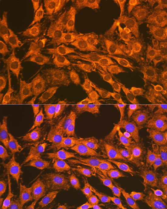 VDAC2 Rabbit Polyclonal Antibody