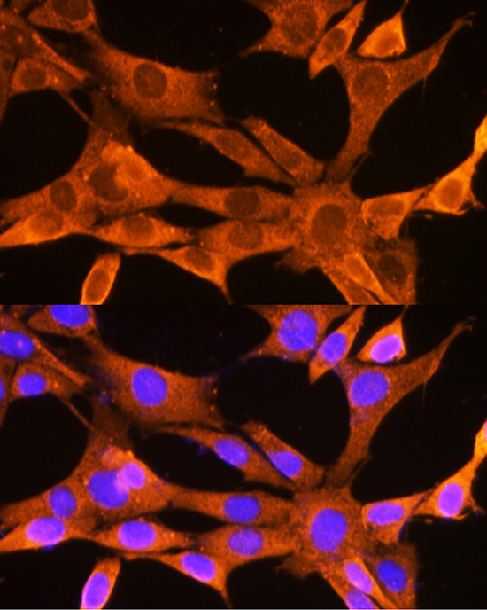 VDAC2 Rabbit Polyclonal Antibody