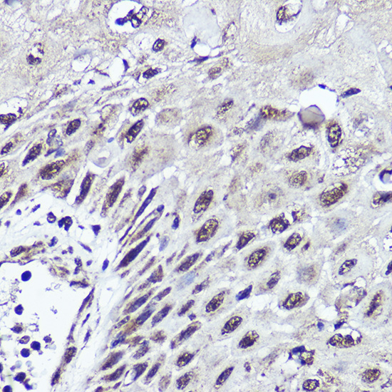 CUX1 Rabbit Polyclonal Antibody