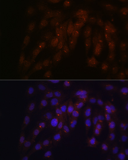 CUX1 Rabbit Polyclonal Antibody