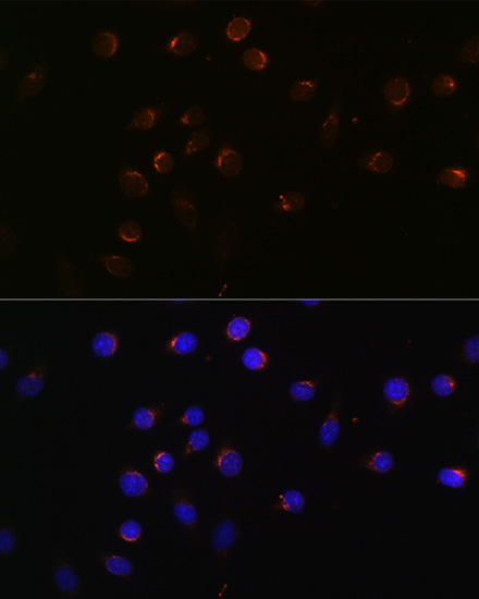 CUX1 Rabbit Polyclonal Antibody