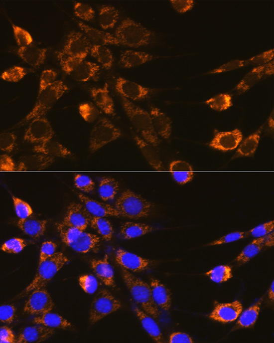 ITGB1 Rabbit Polyclonal Antibody