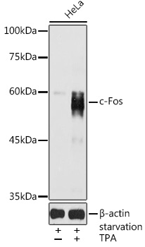 c-Fos Rabbit Polyclonal Antibody