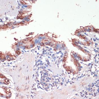 MSI1 Rabbit Polyclonal Antibody