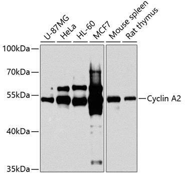 Cyclin A2 Rabbit Polyclonal Antibody